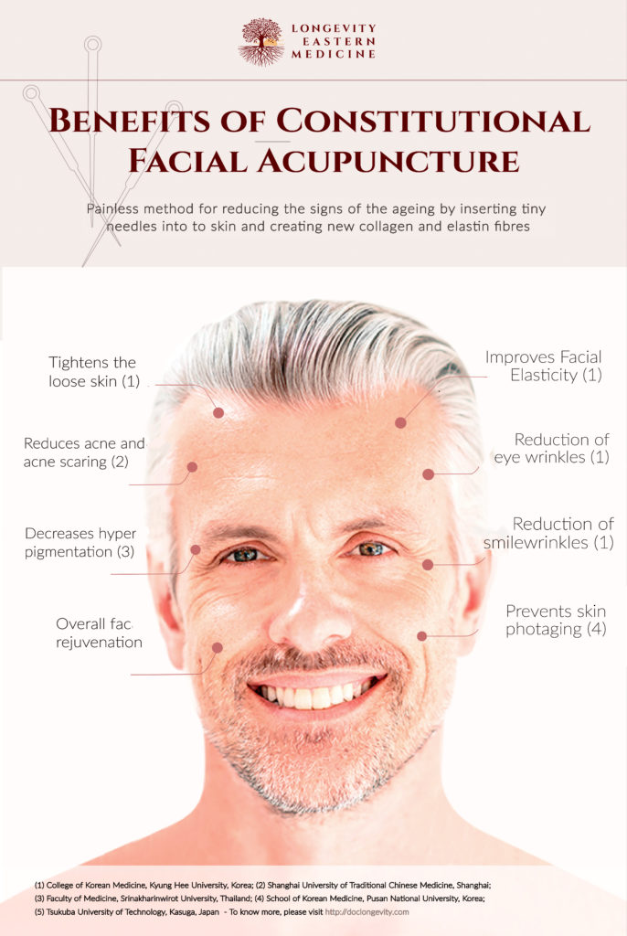 Benefits of constitutional facial acupuncture