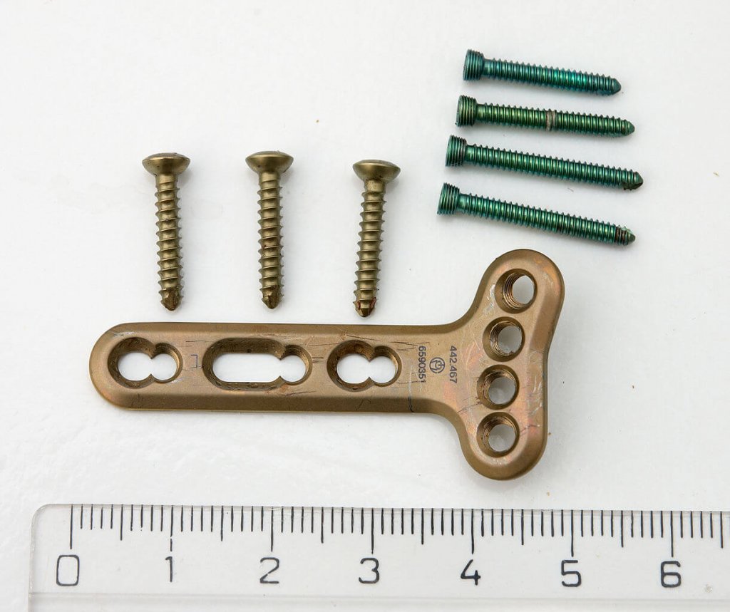 Titanium medical screws