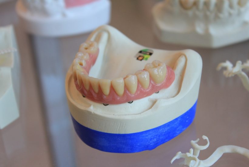 This picture shows a dental prothesis.