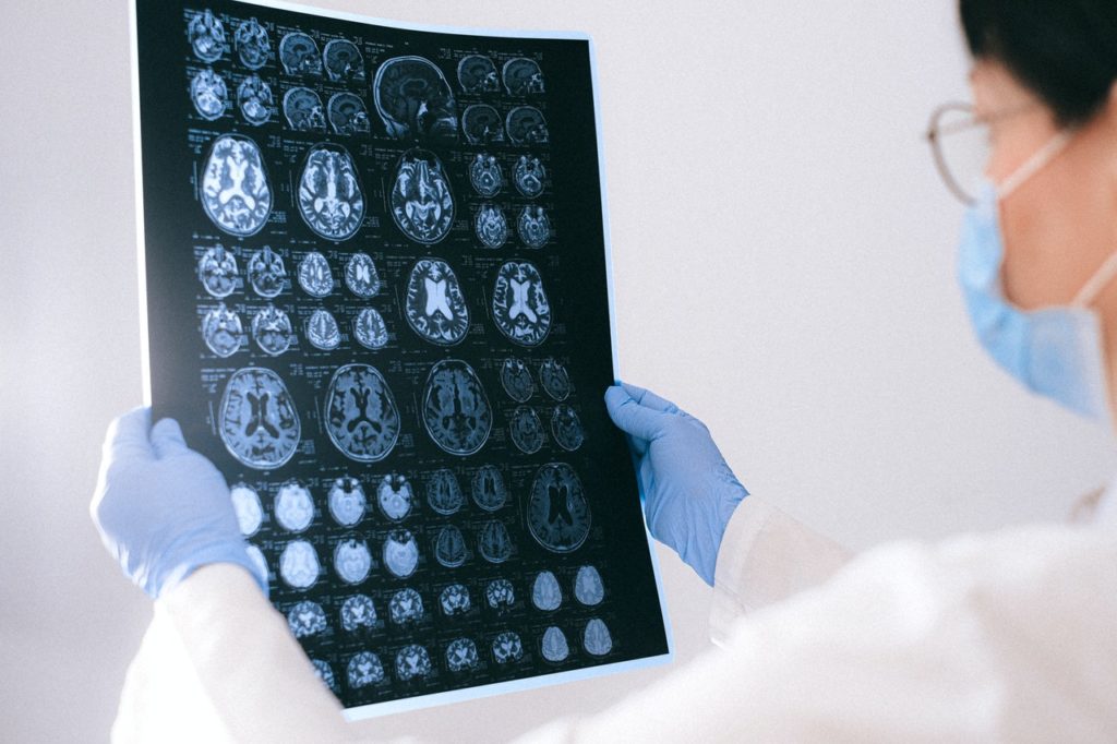 The xB3 patented platform could unlock treatments for hundreds of neurological diseases