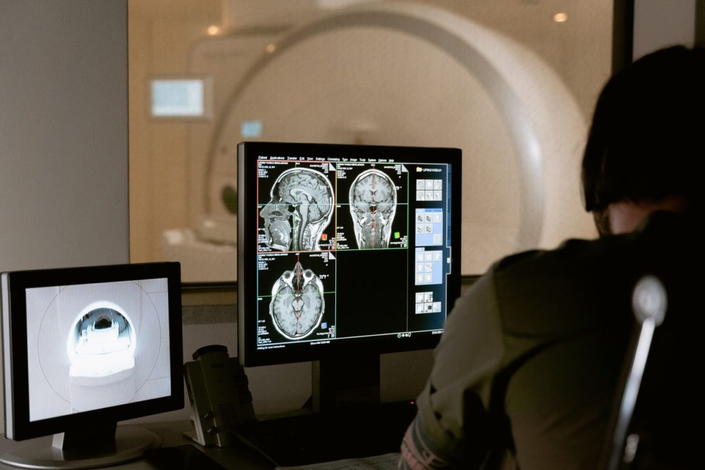 MRI brain scan results
