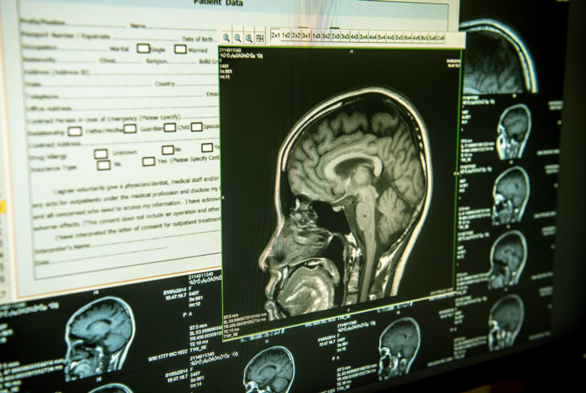Algernon Pharmaceuticals is investigatng new stroke treatments using DMT