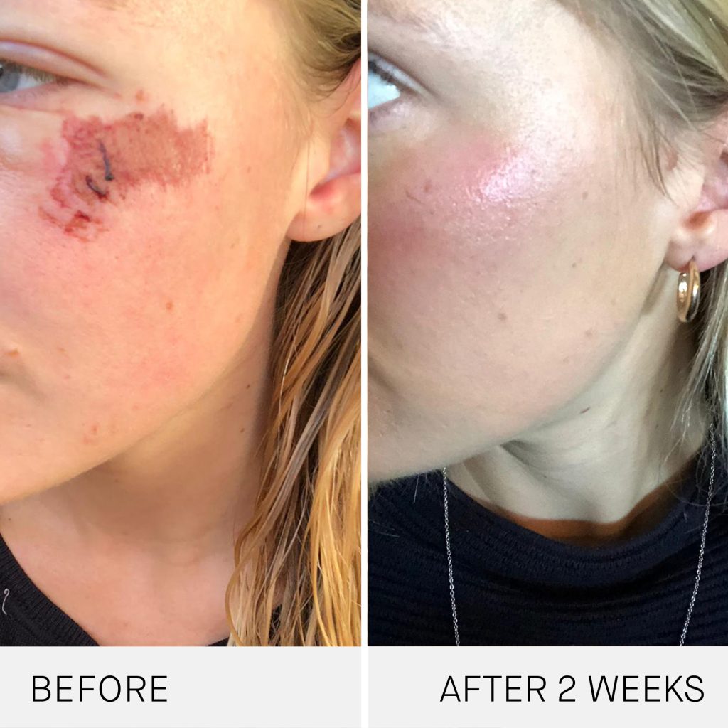 Augustinus Bader skincare results