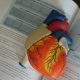 atherosclerosis