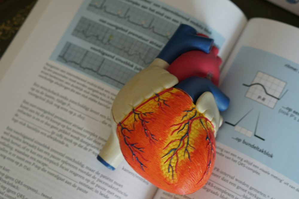 atherosclerosis