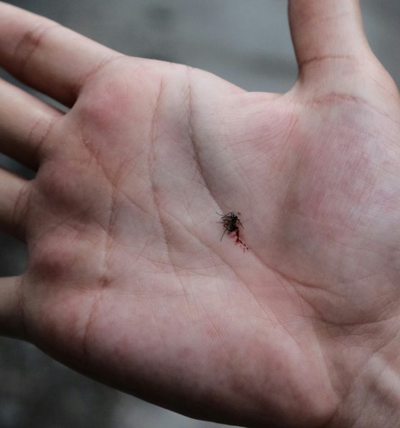 Chagas