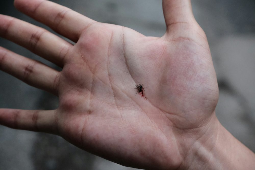 Chagas