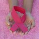 breast cancer