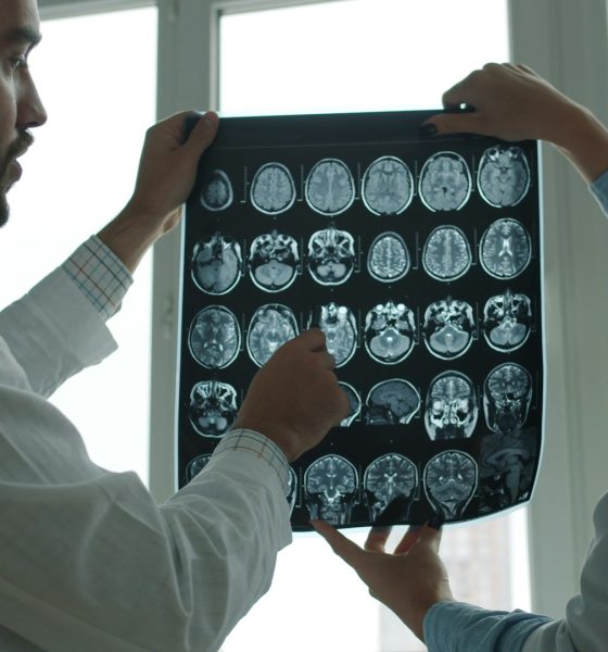 brain