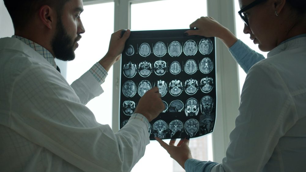 brain