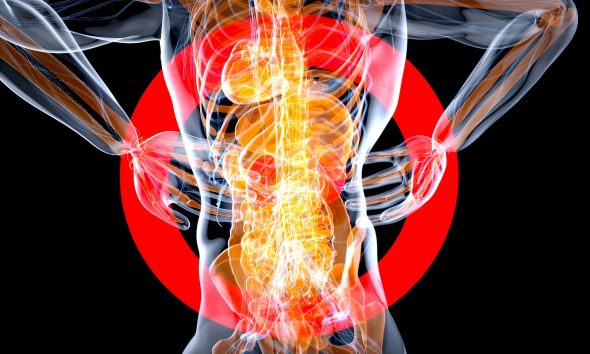 IgA nephropathy