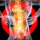 IgA nephropathy